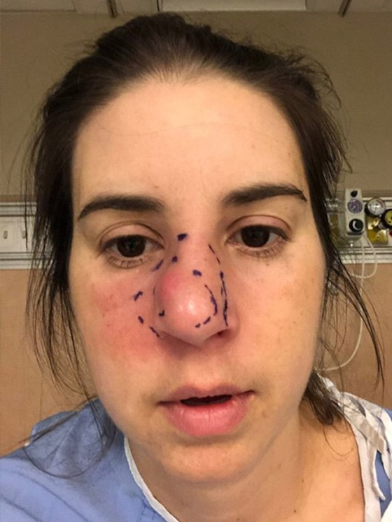 تزيل أنفها بالكامل بسبب آلامها المبرحة صورة رقم 2