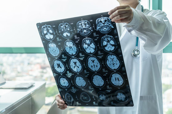 سر بـ30 ثانية.. خطأ قد يفك لغز نشاط للدماغ بعد الموت! صورة رقم 3