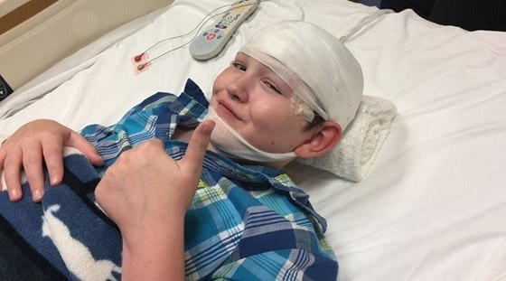 طفل يتحول إلى حجر بسبب حالة نادرة صورة رقم 1