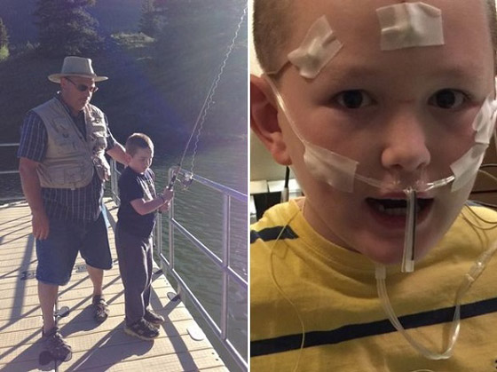 طفل يتحول إلى حجر بسبب حالة نادرة صورة رقم 2