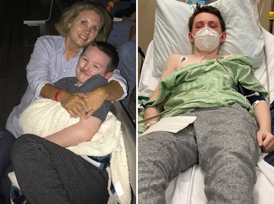 طفل يتحول إلى حجر بسبب حالة نادرة صورة رقم 3