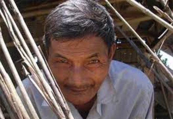 أغرب أشخاص في العالم.. أحدهم لا ينام أبداً وآخر يعيش مثل الكلب صورة رقم 2