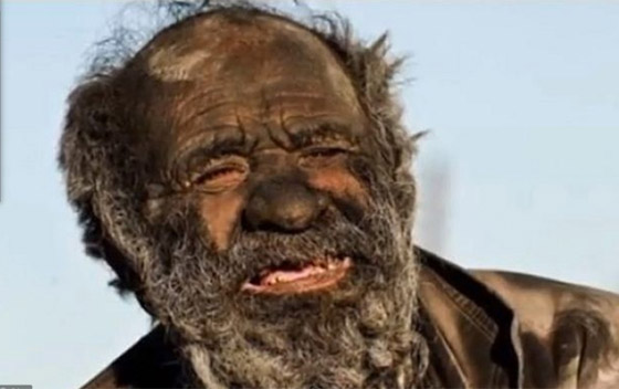 أغرب أشخاص في العالم.. أحدهم لا ينام أبداً وآخر يعيش مثل الكلب صورة رقم 1