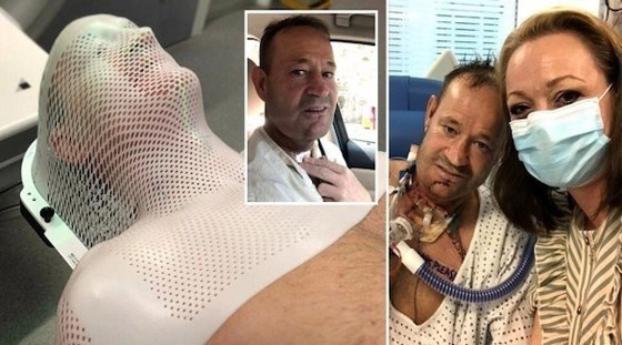 يتغلب على مرض السرطان بفضل وشم في ذراعه صورة رقم 1