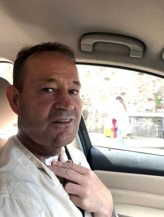 يتغلب على مرض السرطان بفضل وشم في ذراعه صورة رقم 3