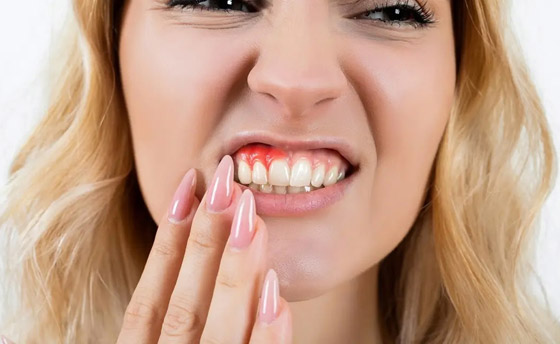 إياكم إهمال صحة الفم.. دراسة تكشف مفاجأة مدوية! صورة رقم 1 إياكم إهمال صحة الفم.. دراسة تكشف مفاجأة مدوية! صورة رقم 1
