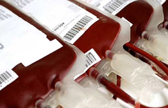 من بينهم دم الانسان...اليكم أغلى 10 سوائل في العالم صورة رقم 1