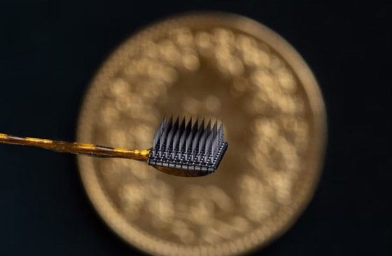 شريحة بالدماغ: أطباء ينجحون بإعادة قدرة الكلام لمريض بالشلل الكلي! صورة رقم 3