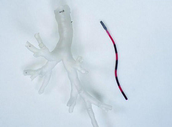 تطور علمي.. روبوت يخترق أنابيب الرئة ويأخذ عينات من الأنسجة! صورة رقم 1