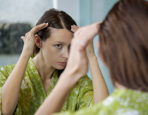 مظهرها يزعجك وتسبب لك الإحراج؟ 8 علاجات طبيعية لفراغات الشعر صورة رقم 1 مظهرها يزعجك وتسبب لك الإحراج؟ 8 علاجات طبيعية لفراغات الشعر صورة رقم 1