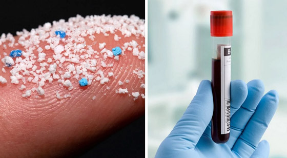 اكتشاف صادم.. دم الإنسان فيه جزيئات من البلاستيك! صورة رقم 1