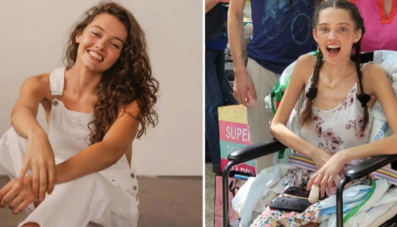 قصة عارضة الأزياء التي فقدت ساقيها بعد إصابتها بفيروس كورونا صورة رقم 1