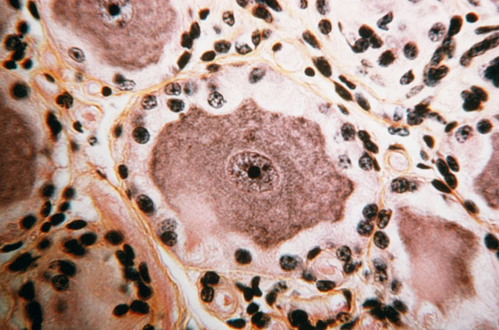 اختراق طبي جديد.. علماء ينشرون أول خريطة كاملة للجينوم البشري صورة رقم 2 اختراق طبي جديد.. علماء ينشرون أول خريطة كاملة للجينوم البشري صورة رقم 2