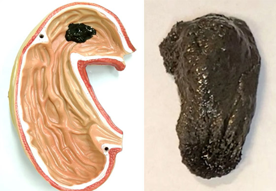 فيديو لا يصدق.. روبوت لزج بخصائص مميزة يدخل أجسادنا! صورة رقم 2 فيديو لا يصدق.. روبوت لزج بخصائص مميزة يدخل أجسادنا! صورة رقم 2