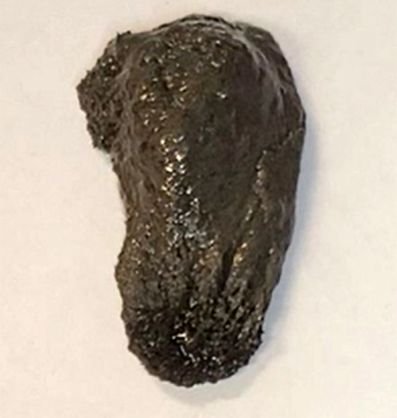 فيديو لا يصدق.. روبوت لزج بخصائص مميزة يدخل أجسادنا! صورة رقم 3 فيديو لا يصدق.. روبوت لزج بخصائص مميزة يدخل أجسادنا! صورة رقم 3