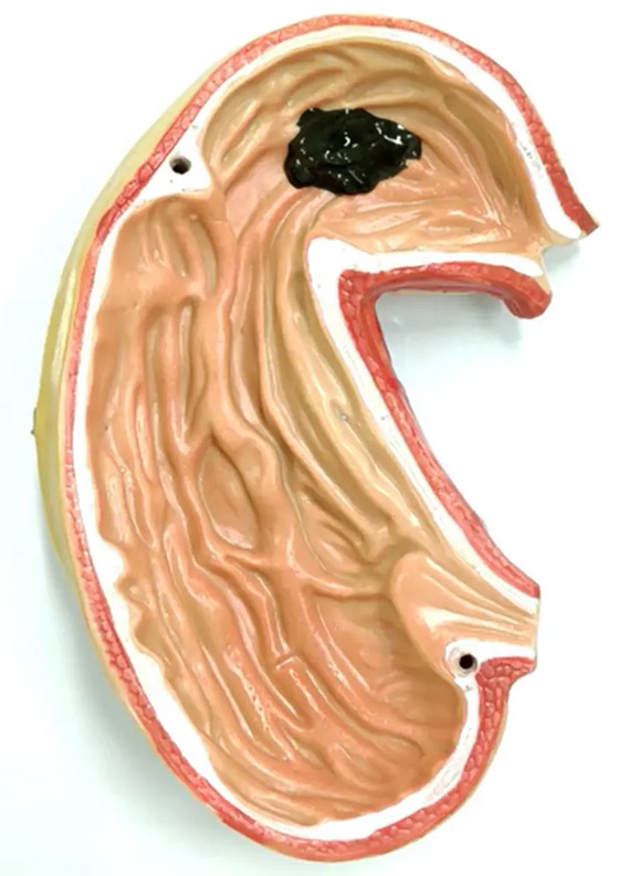 فيديو لا يصدق.. روبوت لزج بخصائص مميزة يدخل أجسادنا! صورة رقم 5 فيديو لا يصدق.. روبوت لزج بخصائص مميزة يدخل أجسادنا! صورة رقم 5