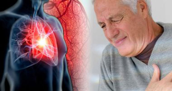 أخطر 10 أمراض في العالم صورة رقم 1 أخطر 10 أمراض في العالم صورة رقم 1