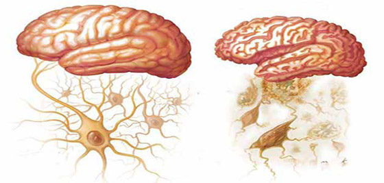 أخطر 10 أمراض في العالم صورة رقم 7 أخطر 10 أمراض في العالم صورة رقم 7