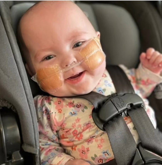 نجاة طفلة من الموت ولدت بمريء منفصل بفضل جراحة رائدة صورة رقم 4