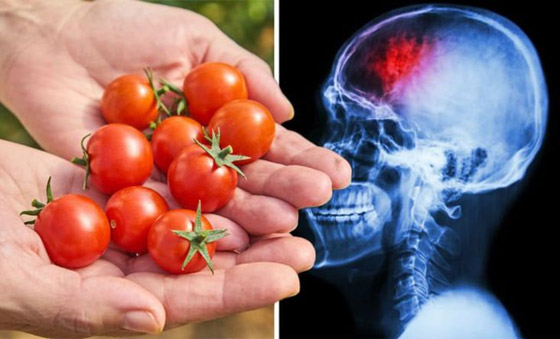 دراسة مدهشة: الطماطم تقلل الإصابة بالسكتة الدماغية صورة رقم 1 دراسة مدهشة: الطماطم تقلل الإصابة بالسكتة الدماغية صورة رقم 1