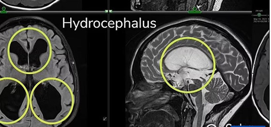 تشخيص خاطئ يدخل شابة إلى مستشفى الأمراض النفسية صورة رقم 3