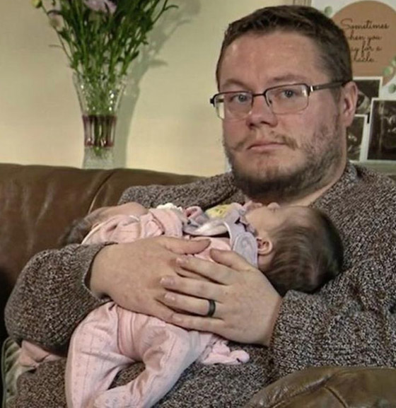 فيديو وصور توأم ملتصق.. معجزة وحالة نادرة! ماذا يقول الوالدان وهل ستتم عملية الفصل؟ صورة رقم 7 فيديو وصور توأم ملتصق.. معجزة وحالة نادرة! ماذا يقول الوالدان وهل ستتم عملية الفصل؟ صورة رقم 7