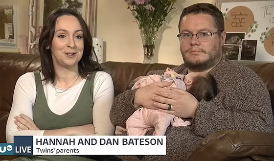 فيديو وصور توأم ملتصق.. معجزة وحالة نادرة! ماذا يقول الوالدان وهل ستتم عملية الفصل؟ صورة رقم 10 فيديو وصور توأم ملتصق.. معجزة وحالة نادرة! ماذا يقول الوالدان وهل ستتم عملية الفصل؟ صورة رقم 10