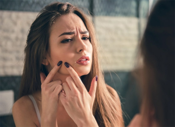 أقوى من المراهم والأدوية.. كيف تتخلص أحماض أوميغا 3 من حب الشباب؟ صورة رقم 4