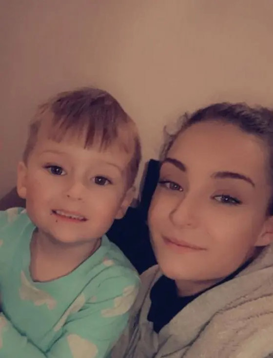 طفل ينجو من الموت بفضل جراحة تم خلالها لصق أجزاء وجهه ببعضها صورة رقم 3