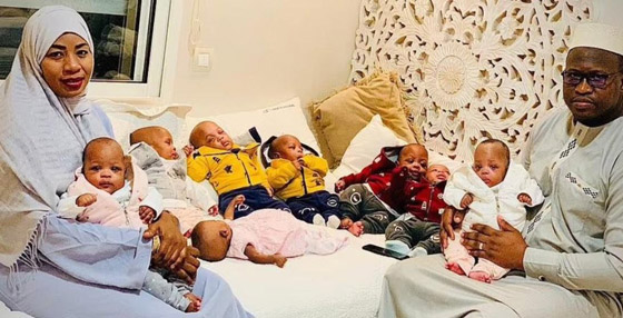 يتلقون الرعاية في شقة طبية.. 9 توأم ماليون يحتفلون بعيد ميلادهما الأول صورة رقم 1