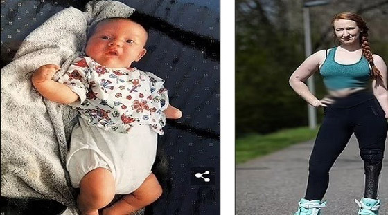 تتحدى إعاقتها وتتعلم التزلج ورفع الأثقال باستخدام الأطراف الاصطناعية صورة رقم 1