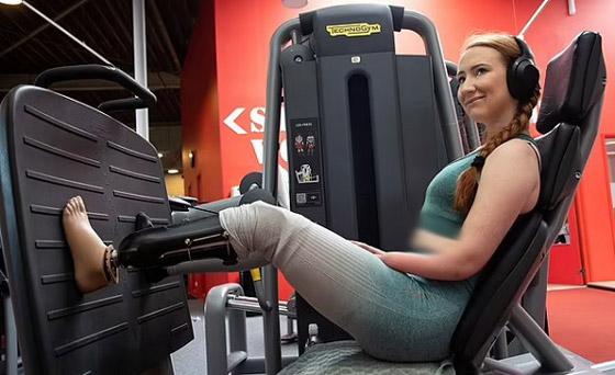 تتحدى إعاقتها وتتعلم التزلج ورفع الأثقال باستخدام الأطراف الاصطناعية صورة رقم 3