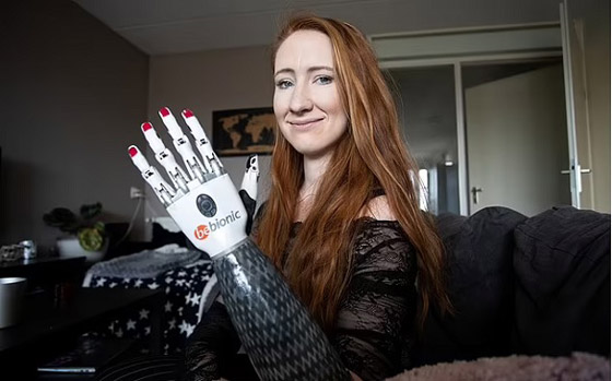 تتحدى إعاقتها وتتعلم التزلج ورفع الأثقال باستخدام الأطراف الاصطناعية صورة رقم 5