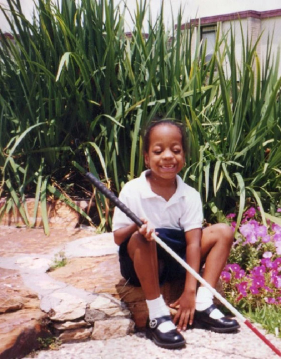 تتحدى حالة نادرة تسببت بـ 100 كسر في جسمها صورة رقم 2