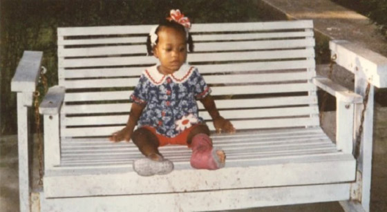 تتحدى حالة نادرة تسببت بـ 100 كسر في جسمها صورة رقم 4