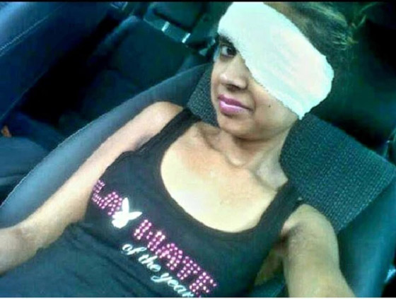 صور...تصاب بحروق شديدة أثناء المخاض بسبب حالة صحية نادرة صورة رقم 2