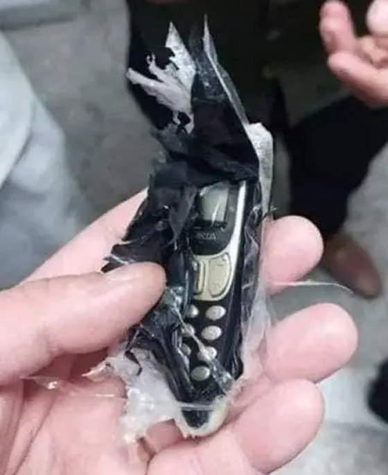 صور: استخراج هاتف محمول من بطن شاب مصري صورة رقم 4