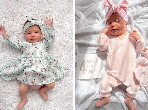 طفلة تولد بابتسامة دائمة بسبب حالة نادرة صورة رقم 3