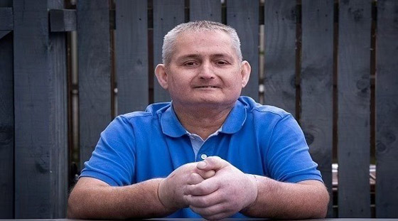 يخضع لأول عملية زرع يد مزدوجة في العالم بعدما أصيب بتصلب الجلد صورة رقم 1