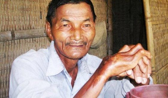 تعرفوا إلى 10 أشخاص يمتلكون قدرات خارقة عجز العلم عن تفسيرها! صورة رقم 2