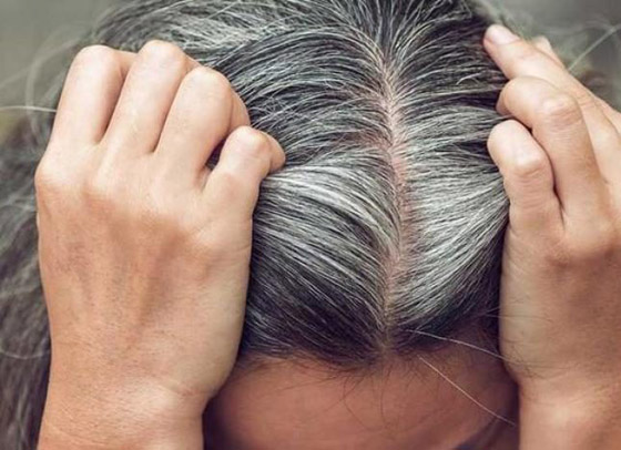 ظهور الشيب يرجع إلى نقص هذه العناصر الغذائية.. فما هي؟ صورة رقم 4