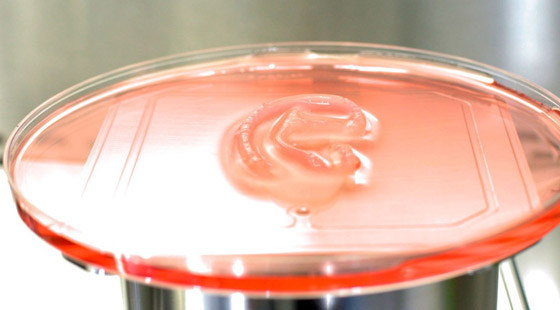 الأولى من نوعها.. عملية زرع أذن مطبوعة لكنها 