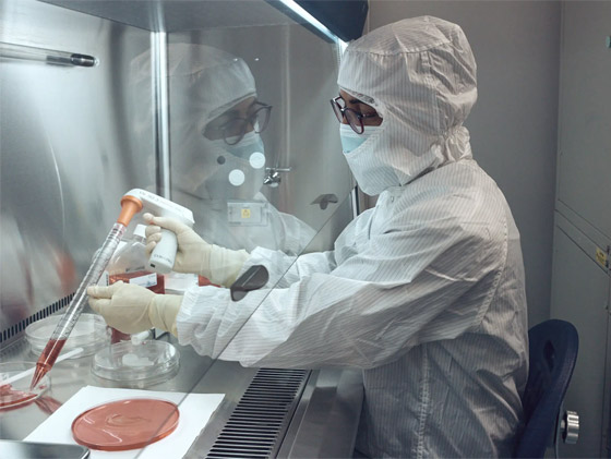 الأولى من نوعها.. عملية زرع أذن مطبوعة لكنها 