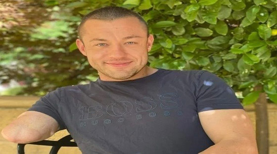 يفقد ذراعه بسبب حادث غريب أثناء رفع الأثقال صورة رقم 1