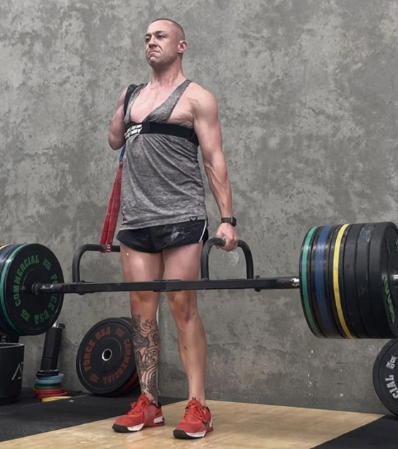 يفقد ذراعه بسبب حادث غريب أثناء رفع الأثقال صورة رقم 3