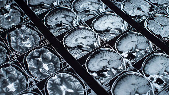 أدمغة البشر كانت أكبر حجما قبل 3 آلاف عام.. فهل كنا أكثر ذكاء؟ صورة رقم 5