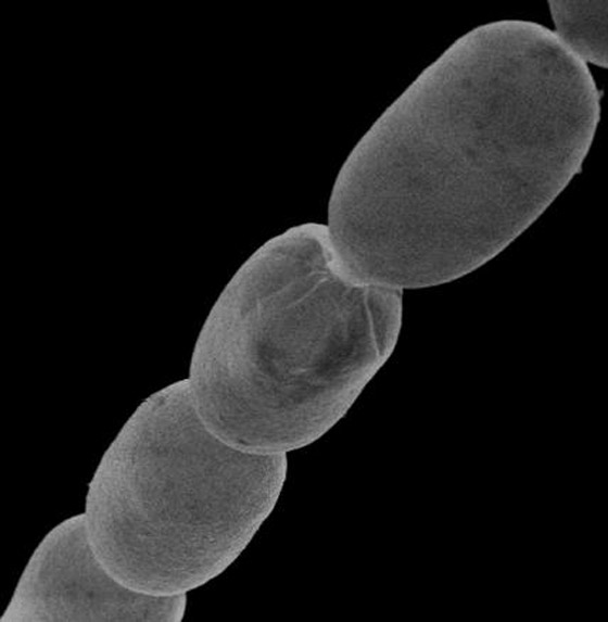 اكتشاف أكبر بكتيريا في العالم.. تُرى بالعين المجردة! فيديو وصور صورة رقم 3