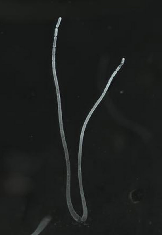 اكتشاف أكبر بكتيريا في العالم.. تُرى بالعين المجردة! فيديو وصور صورة رقم 4