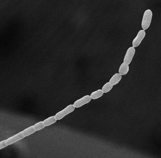 اكتشاف أكبر بكتيريا في العالم.. تُرى بالعين المجردة! فيديو وصور صورة رقم 5