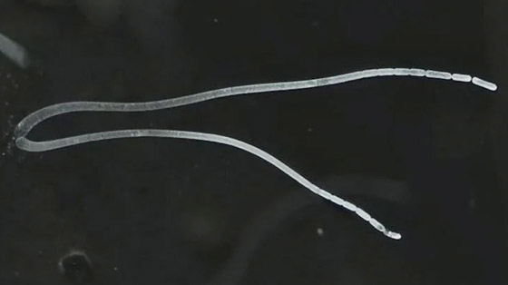 اكتشاف أكبر بكتيريا في العالم.. تُرى بالعين المجردة! فيديو وصور صورة رقم 12